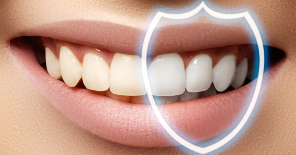 5 Factors That Determine Whether Dental Bonding Can Be Repaired Or Replaced