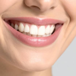 5 Ways A Subtle Dental Smile Enhancement Can Preserve Natural Character